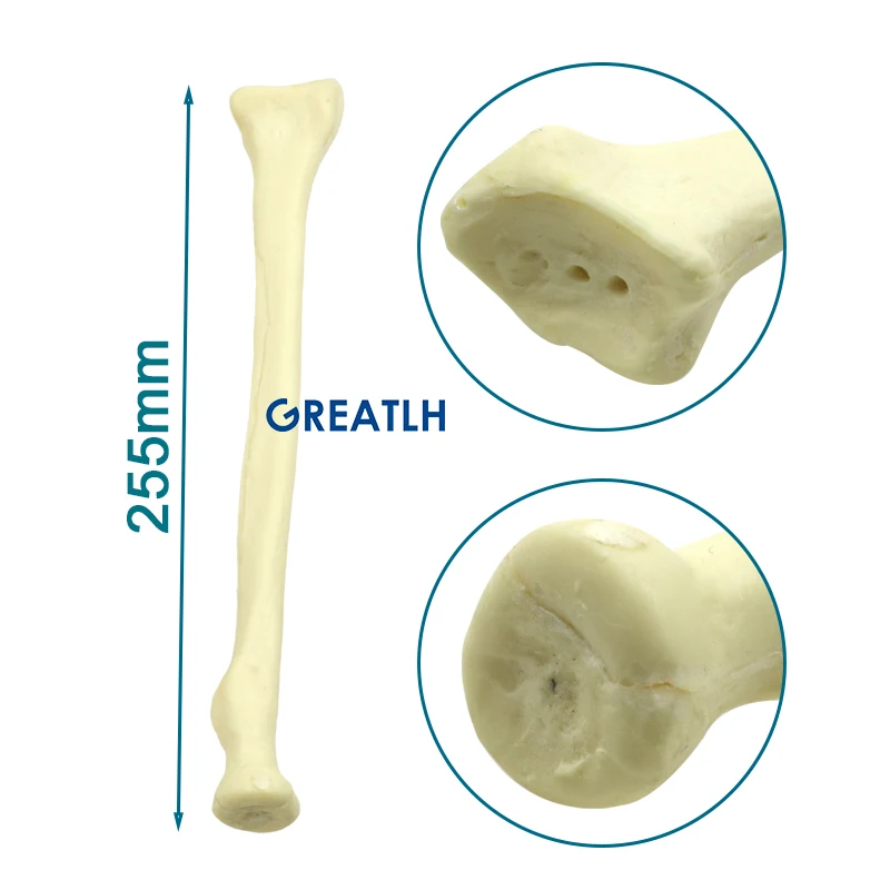 Human Skeleton Model Radius Practice Drilling Model Medical Teaching Model