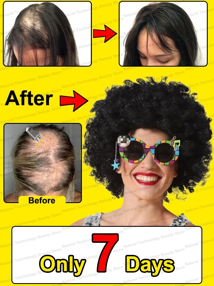 

Scalp applicator, head minor applicator, dil hair growth solution, ball massage essential oil, introduction, comb coating