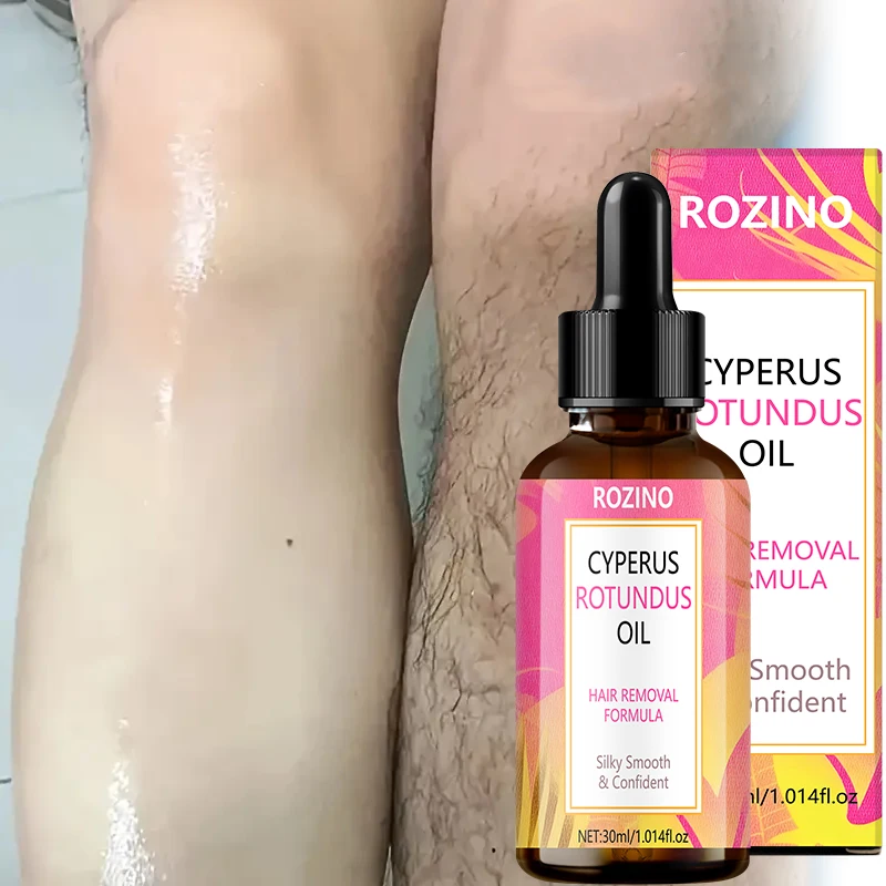 【Instant Soothing】30Ml Post-Hair Removal Care Oil, Moisturizing, Soothing, Relaxing, Gentle, Cools and Soothes Skin after Shaving/Hair Removal, Leaves Legs Feeling Fresh/Cooled, Makes Skin Healthier, Soothes/Cools Dry and Irritated Skin, Suitable for Face, Legs, Arms, Underarms, Lips, Chest,
