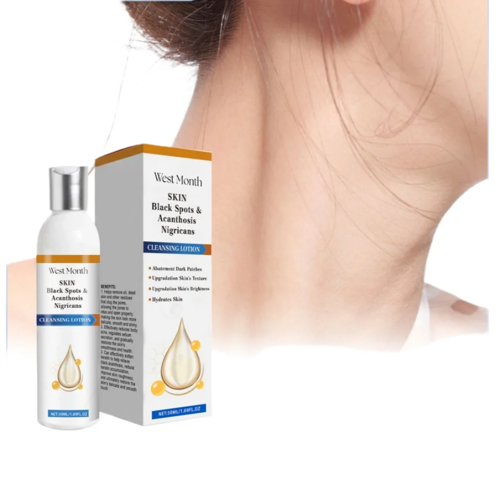 

Black Acanthus Skin Cleaning Lotion - Soft, Moist & Refreshing, Deep Hydration for Elbow & Neck Care, Nourishing Body Lotion