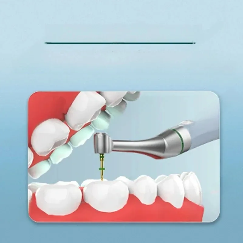 COXO C-Dental Wireless Endo 16:1 360°Adjustable Handpiece Root Canal Treat-Mode Endodontic Motor