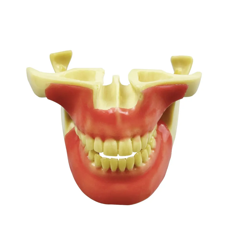 Dental Oral Model Anchorage Nail Exercise Model Foaming Simulated Bone Model Dental implant Practice Teaching Model