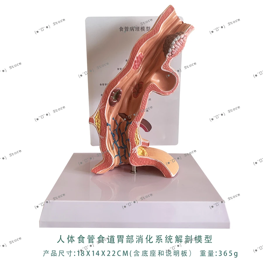 

Human Esophagus Esophagus Stomach Digestive System Anatomy Model Teaching Visceral Anatomy Human Teaching Aids