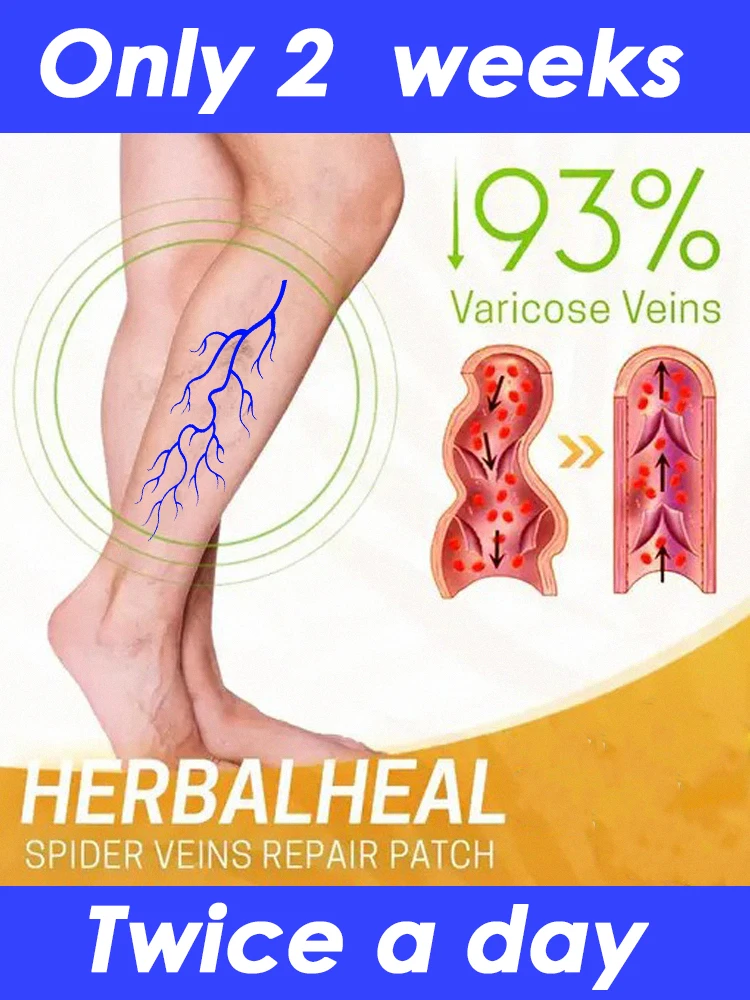 

South Moon Third Generation Varicose Vein Cream Relieves Spider Veins