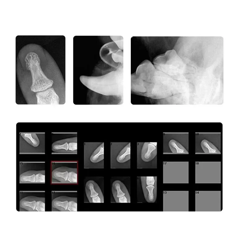 Portable X-ray Machine X Ray Unit Compatible with Digital Sensor X-ray Film Lab Equipment