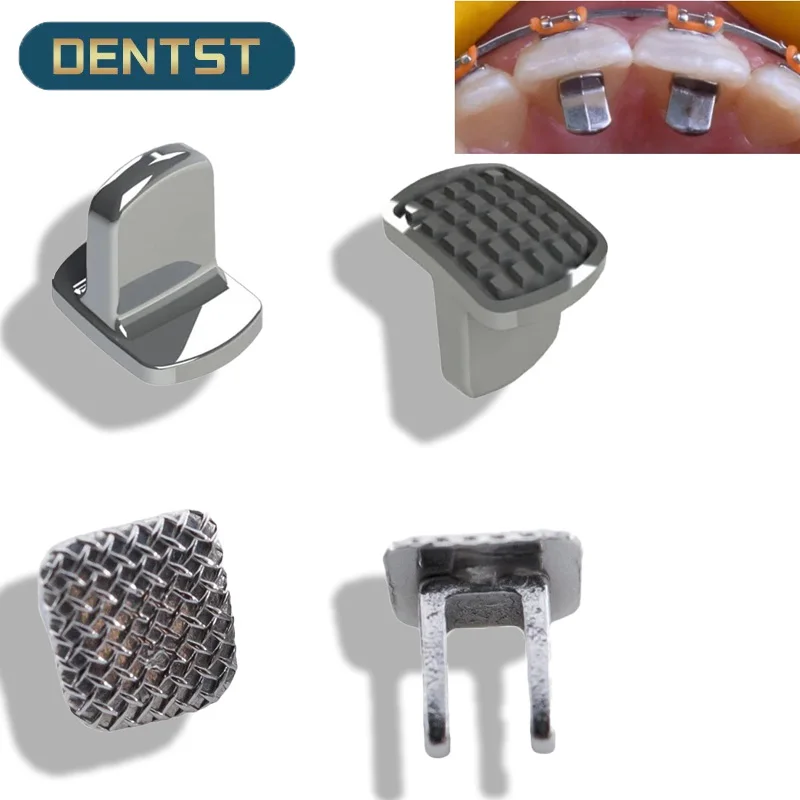 10pcs Dental Orthodontic Monoblock Bite Ramp Bite Turbos Bite Opener Stopper Single Wing Builder Bondable Hinge Tongue Tamers