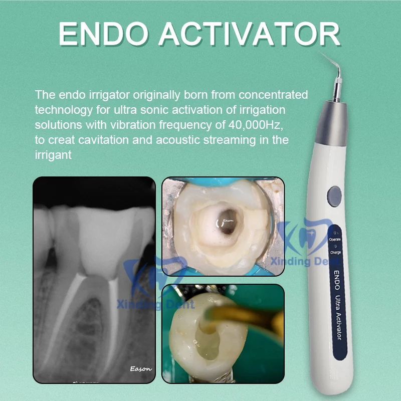 ทันตกรรม LED ไร้สาย Ultrasonic Activator Endo Ultra Activator Root Canal ชลประทาน Endodontic Treatment ทันตกรรมเครื่องมือ