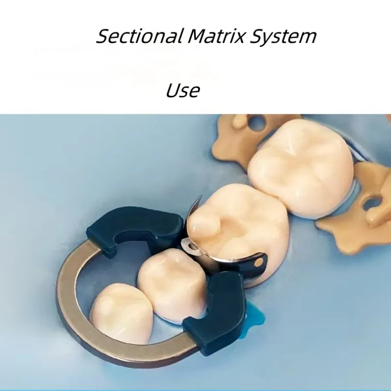 Zahnmedizin feste Form matrix Dental Universal/schmaler Klemm ring autoklav ier bares Zahnmatrix-Klemm system Zahnarzt ausrüstungen