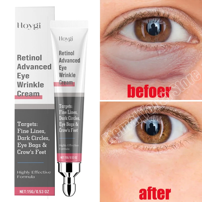 Instant Eye Bag Removal Cream Retinol Anti-Wrinkle Firming Skin Fade Fine Lines Anti Dark Circle Puffiness Brighten Eye Care