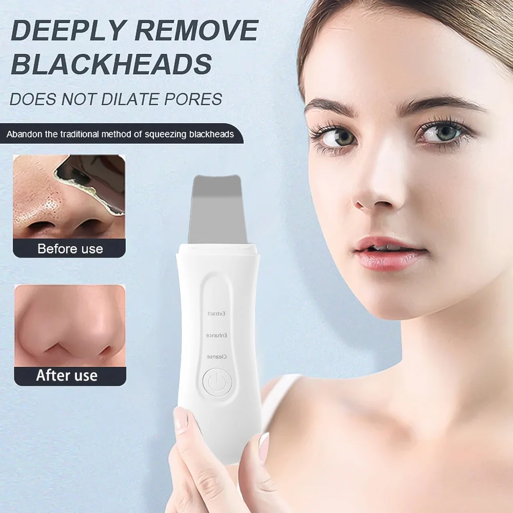 Ultrasone Huid Scrubber Peeling Comedondrukker Diepe Gezichtsreiniging Ultrasone Ion Acne Pore Cleaner Facial Schop Scrubber
