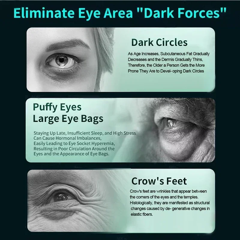 เครื่องนวดตาไฟฟ้าต่อต้านริ้วรอย Aging EMS Eye Beauty เครื่องมือนวดชาร์จตาความเมื่อยล้าบรรเทา Anti Dark Circle อุปกรณ์