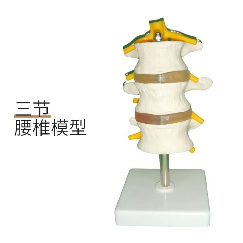 

Simulated Human Lumbar Model Simple Universal Vertebrae Structure Intervertebral Disc Pathology Vertebrae L