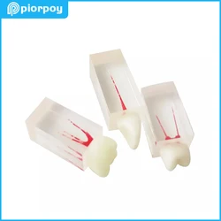 Dental Endodontic Root Canal Block Model Dentistry Education Teaching Resin Endo Training RCT Practice Pulp Cavity Tooth Models