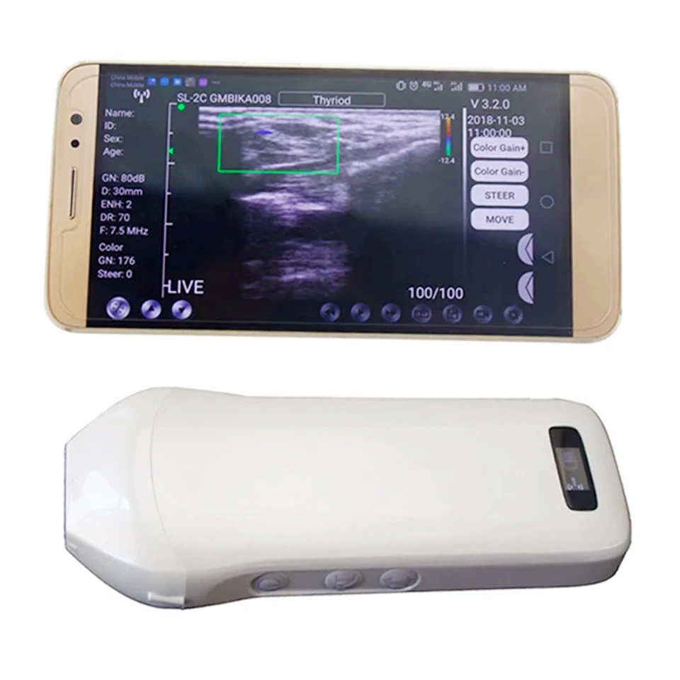 Wholesale Portable Handheld Linear Convex Ultrasound Probe 3 In 1 Wifi Ultrasound Probe Doppler Wireless Ultrasound Probe