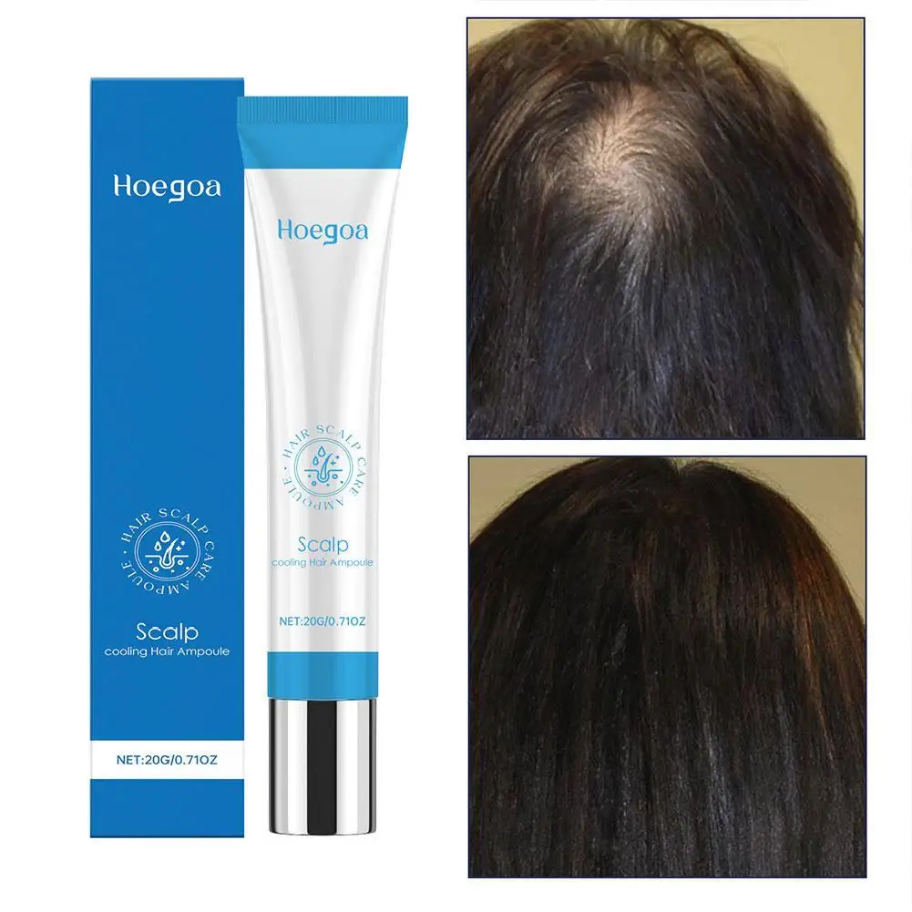 

20g Scalp Reboost Roller Nourishing Hair Oil Hair Hair Roll-on Serum Roller Growth Treatment Hair Care