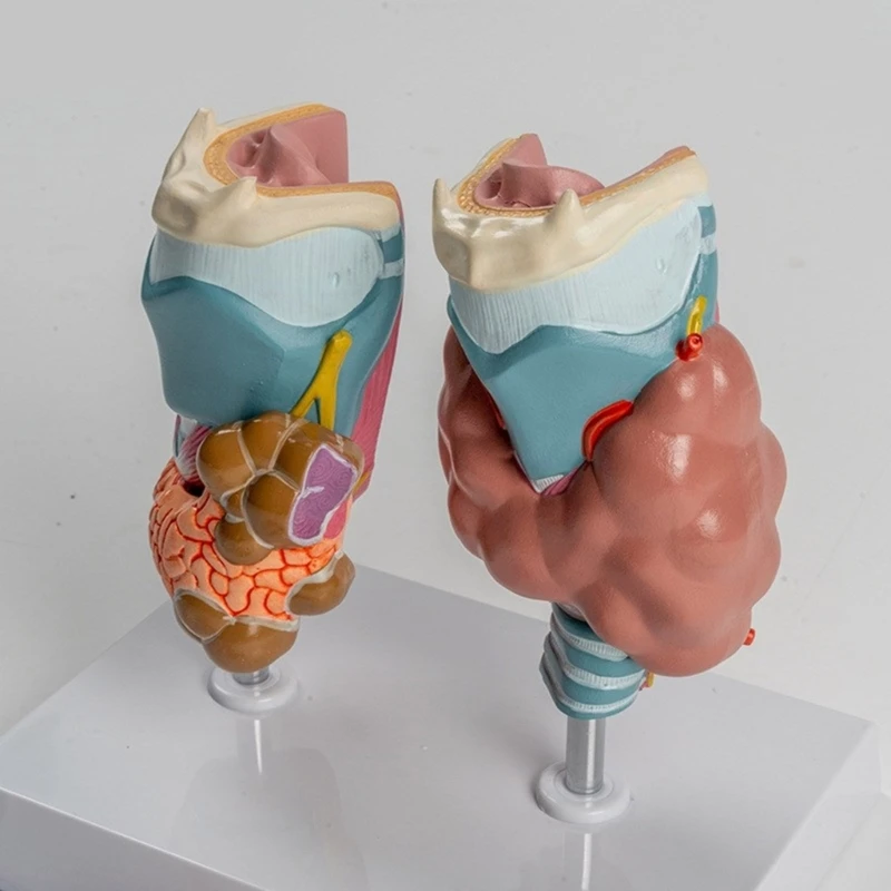 Модель патологической анатомии щитовидной железы со съемной частью, анатомическая модель щитовидной железы