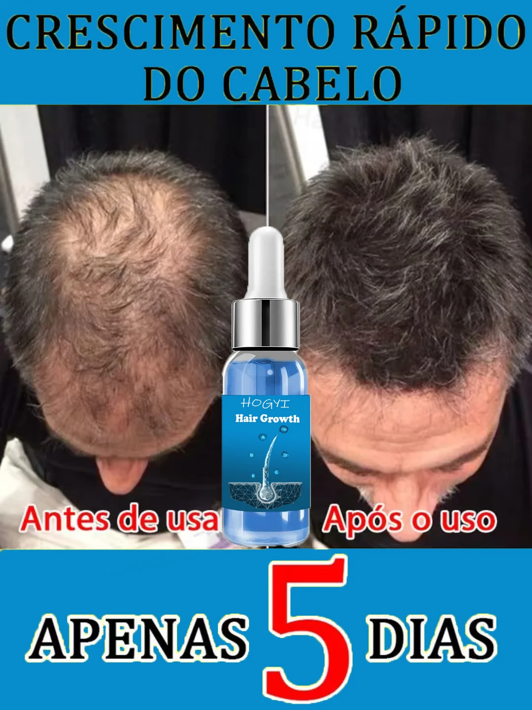 Hot selling product, 99% of buyers buy again, have more and more hair, say goodbye to baldness, thick hair