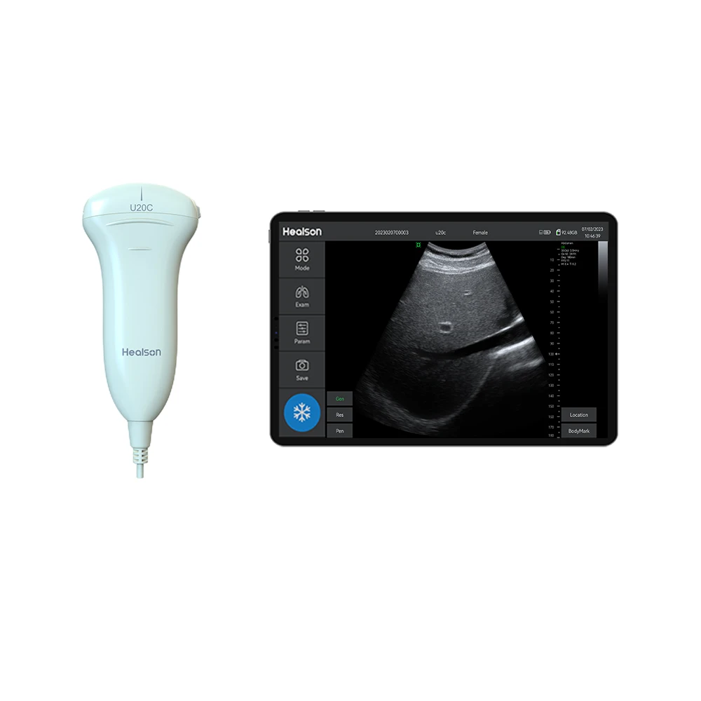 Healson Portable ultrasound handheld device dual frequency probe ultrasound USG machine With tablet computer