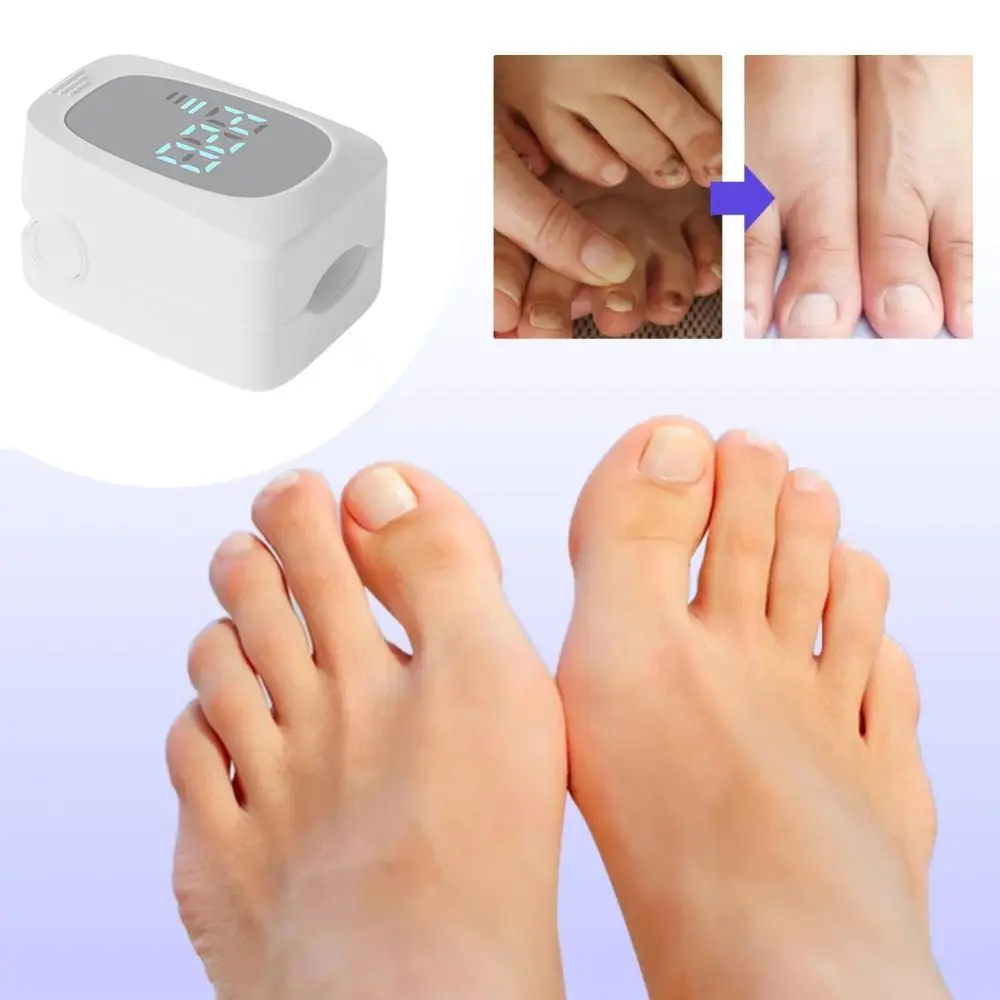 Rechargeable Nail Fungus Cleaning Light Device For Onychomycosis USB Charge Durable Nail Repair Tool Easy To Carry For Travel And Home Use with Timer