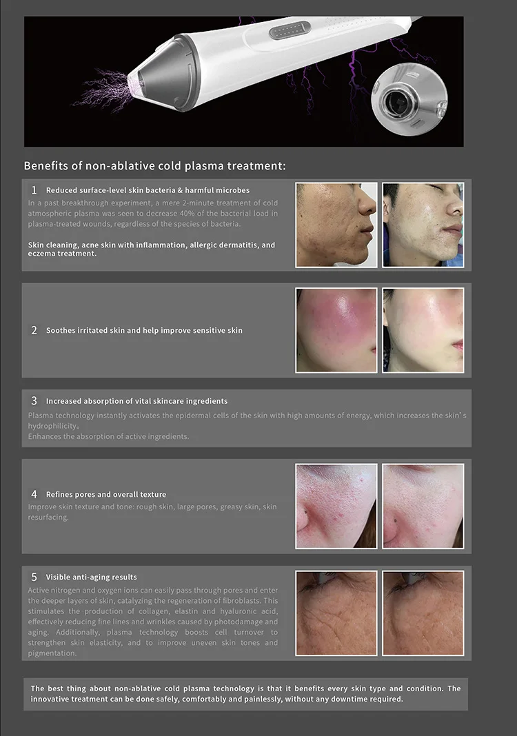 المكتبة الذكية 2025 معدات بلازما التجميل الجديدة المبتكرة متعددة الوظائف 3 في 1 تقنية الوجه بالبلازما الكسور والباردة