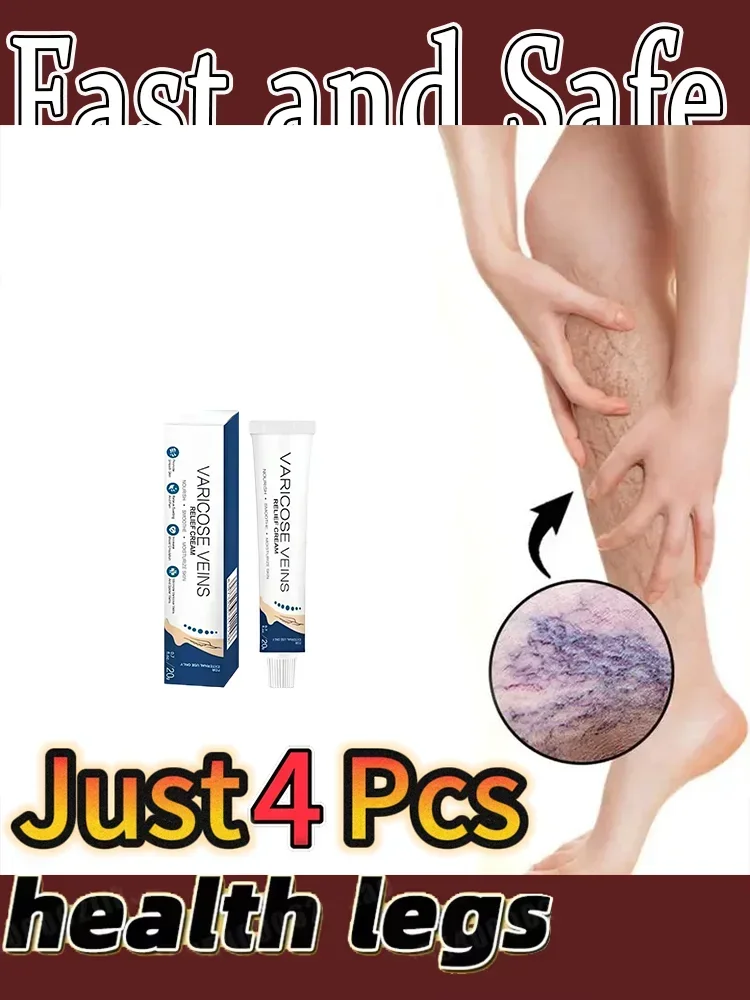 ¦¦¦¦¦¦Spider blood vessels varicose veins Effective varicose vein relief cream to relieve vasculitis phlebitis spider pain treat