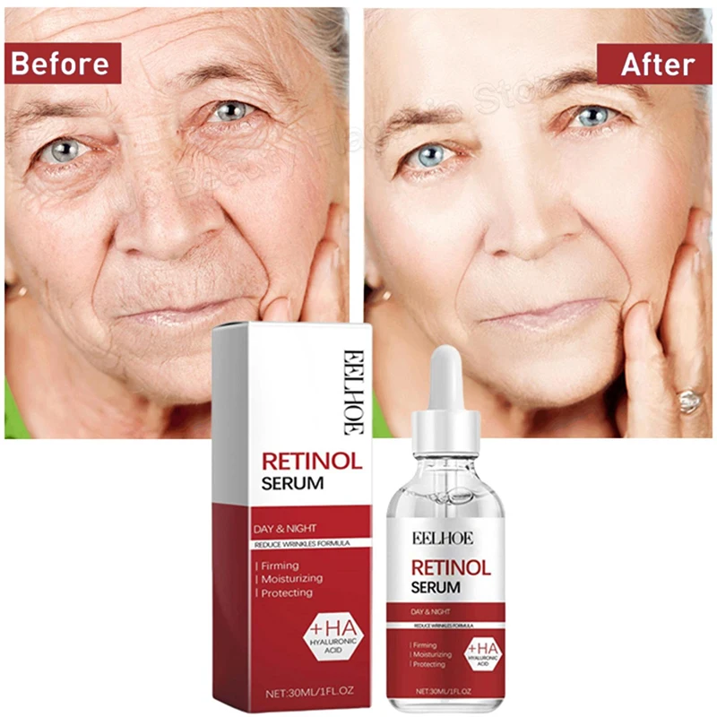 Retinol Wrinkle Remover Face Serum Instant Firming Lifting Anti-Aging Liquid Fade Fine Lines Whitening Korean Skin Care Products