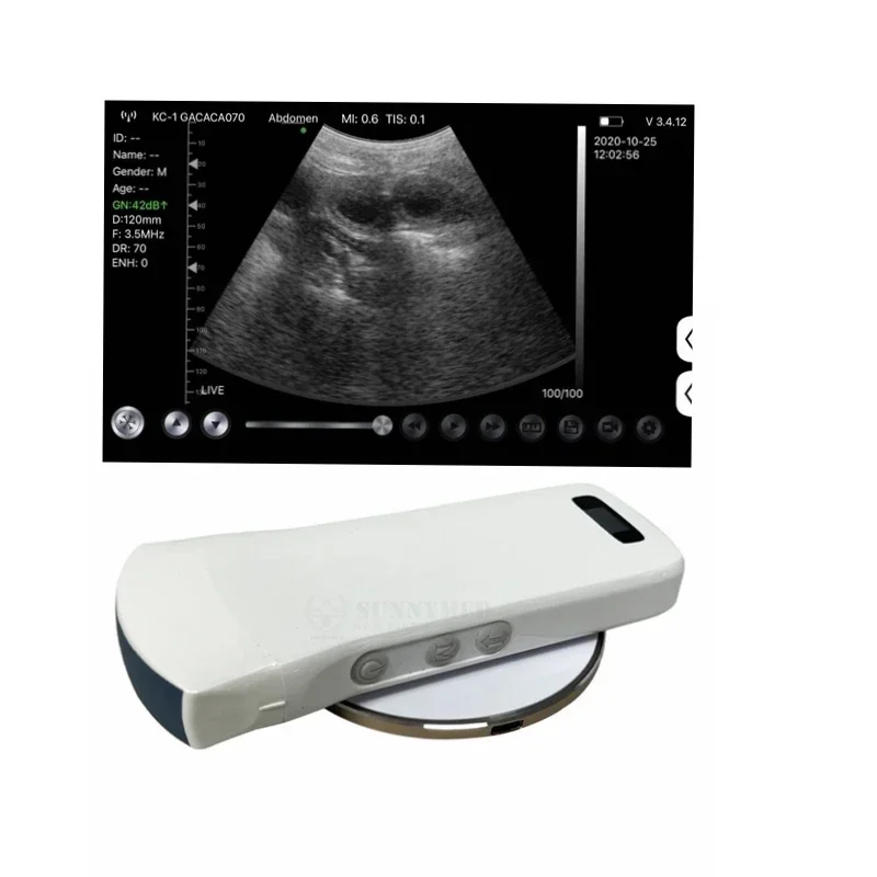 

SY-A0C1 black and white wireless ultrasound probe 128 elements wireless hand held convex ultrasound probe for Abdomen