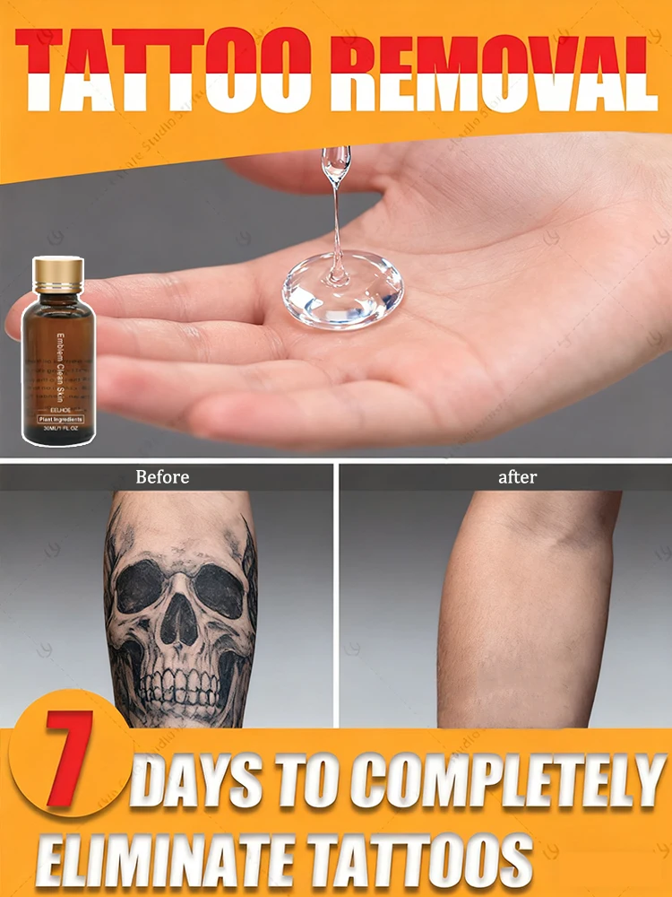 

Quick Tattoo Removal Serum in 7 Days