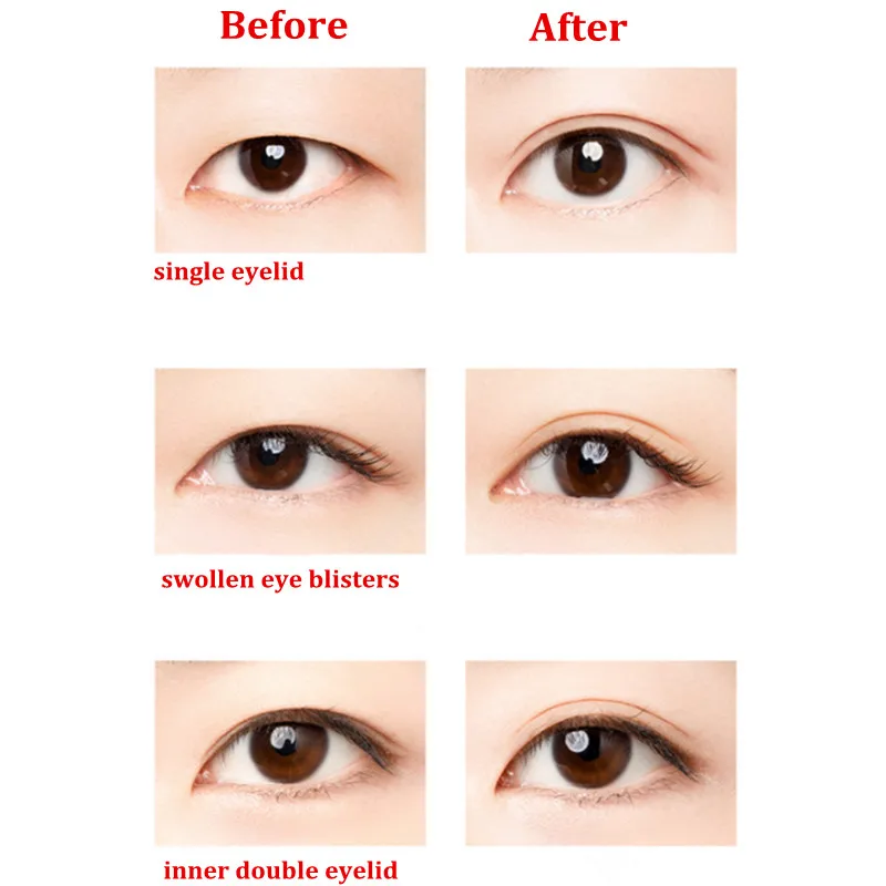 U N N Y Augenlid-Klebeband-Aufkleber, unsichtbar, doppelt gefaltet, Augenlid-Paste, beige Streifen, selbstklebendes natürliches Augenband, Make-up-Werkzeug – Detail 7