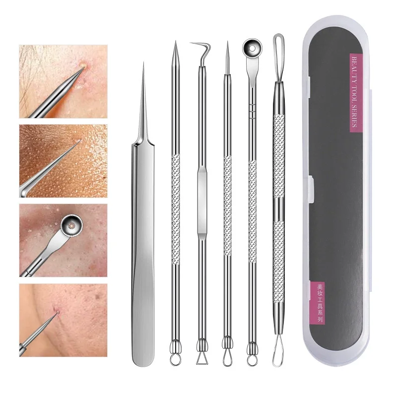 2-8 Stuks Puistje Popper Tool Kits Ultrafijne Mobiele Puistjes Mee-eter Extractor Clip Pincet Acne Naald gereedschap Gezichtsreiniger Huid
