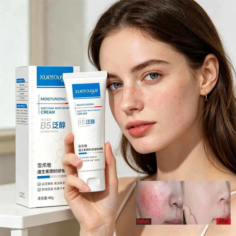 Creme B5 para Redução de Vermelhidão Facial, Remoção Instantânea de Varizes, Suavização da Pele Sensível, Tratamento Anti-Vermelhidão e Rosácea, Loção Cosmética Coreana
