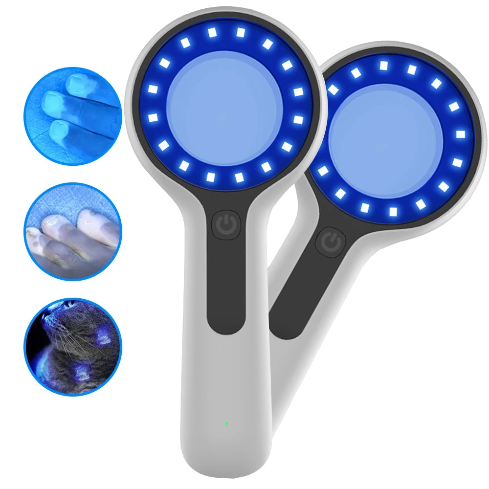 جديد وودز مصباح الجلد محلل المحمولة صالون الوجه محلل التجميل الأشعة فوق البنفسجية مصباح الخشب أمراض الجلد لتحليل اختبار الفحص