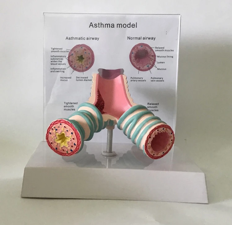 Human asthma trachea anatomy model bronchial model medical model