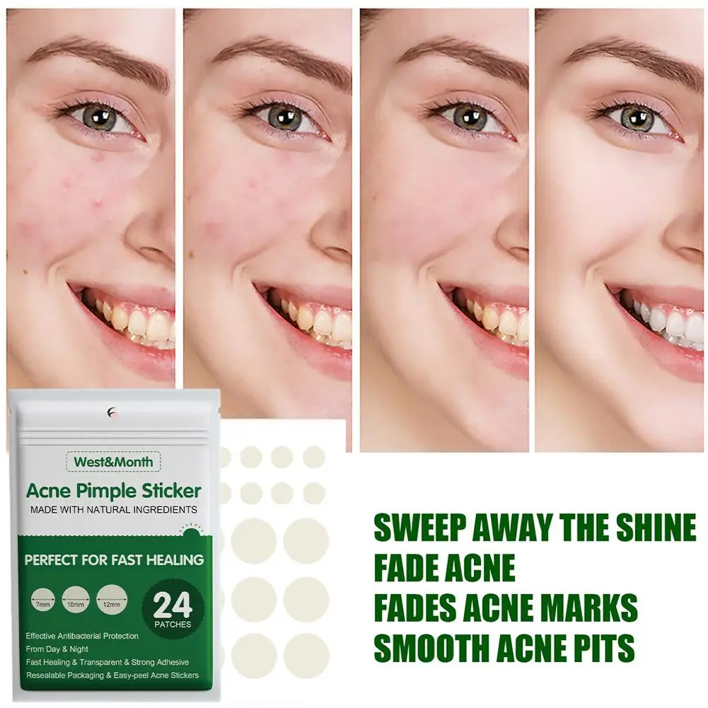 24/36Pcs Acne Pimple Patch Sticker Acne Treatment Pimple Care Mask Facial Remover Tool Маска Blemish Skin Spot Лица Для K9K2