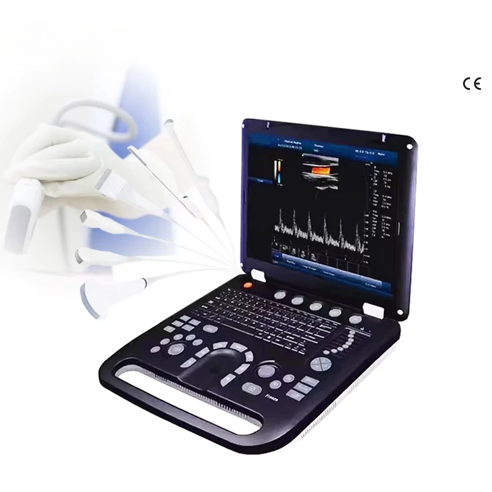 Medical Equipment Large Screen Diagnostic Ultrasound Machine Trolley Color Doppler Ultrasound Scan