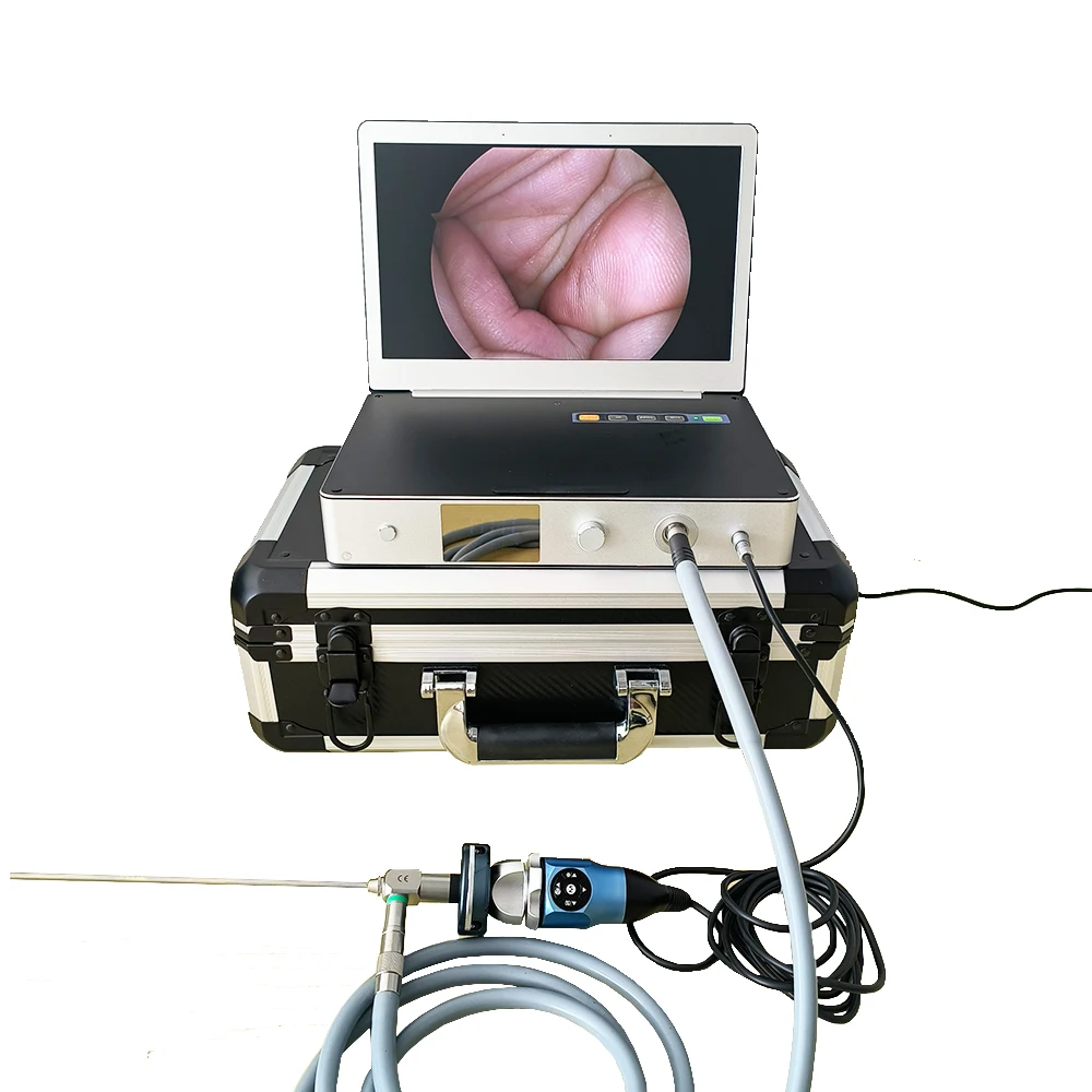 

Portable all in one HD FHD 1080P Surgical Medical Endoscope for ENT/Laparoscopy/Hysteroscopy/Urology Surgery