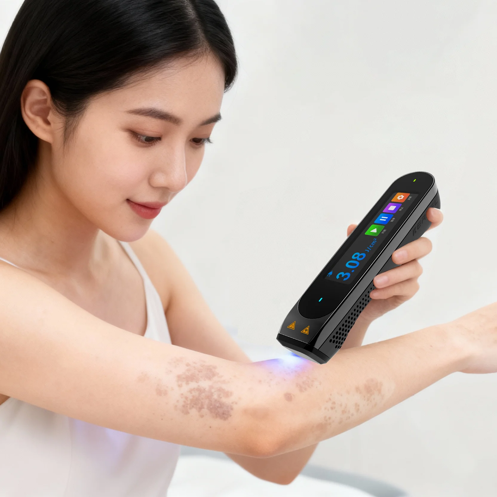 Lámpara Excimer CN-308P1 Kernel al Mejor Precio, Máquina de Terapia Láser 308 para Vitiligo y Psoriasis