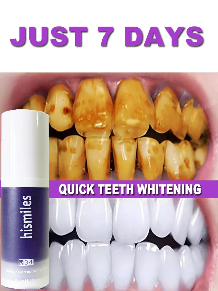 V34 Teeth Whitening Mousse Toothpaste Remove Stains Dental Plaque Deep Cleaning Improve Yellow Teeth Fresh Breath Products Care