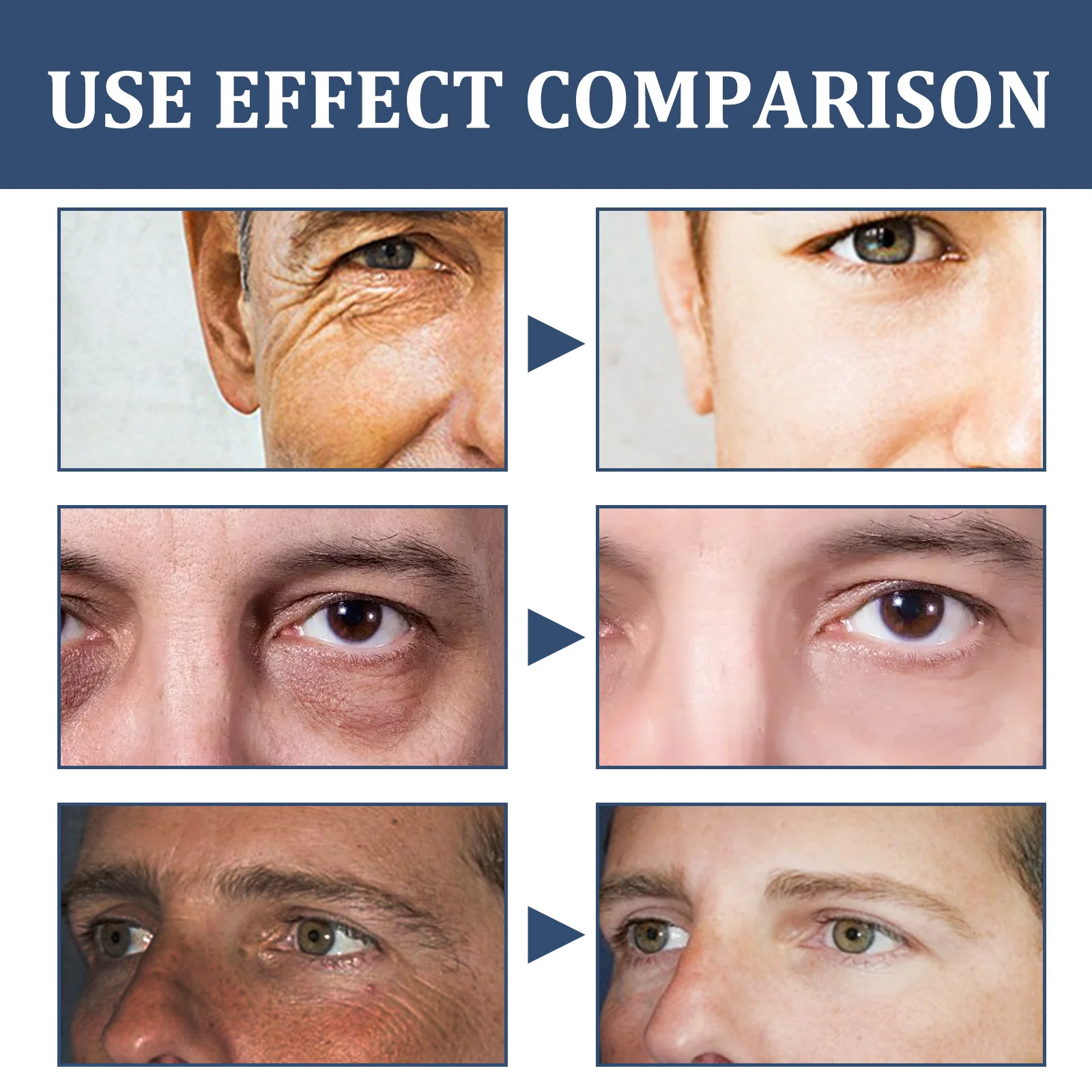 6 IN1 كريم مرطب حمض الهيالورونيك للوجه للرجال ترطيب البشرة تفتيح الهالات السوداء المضادة للانتفاخ تتلاشى الخطوط الدقيقة
