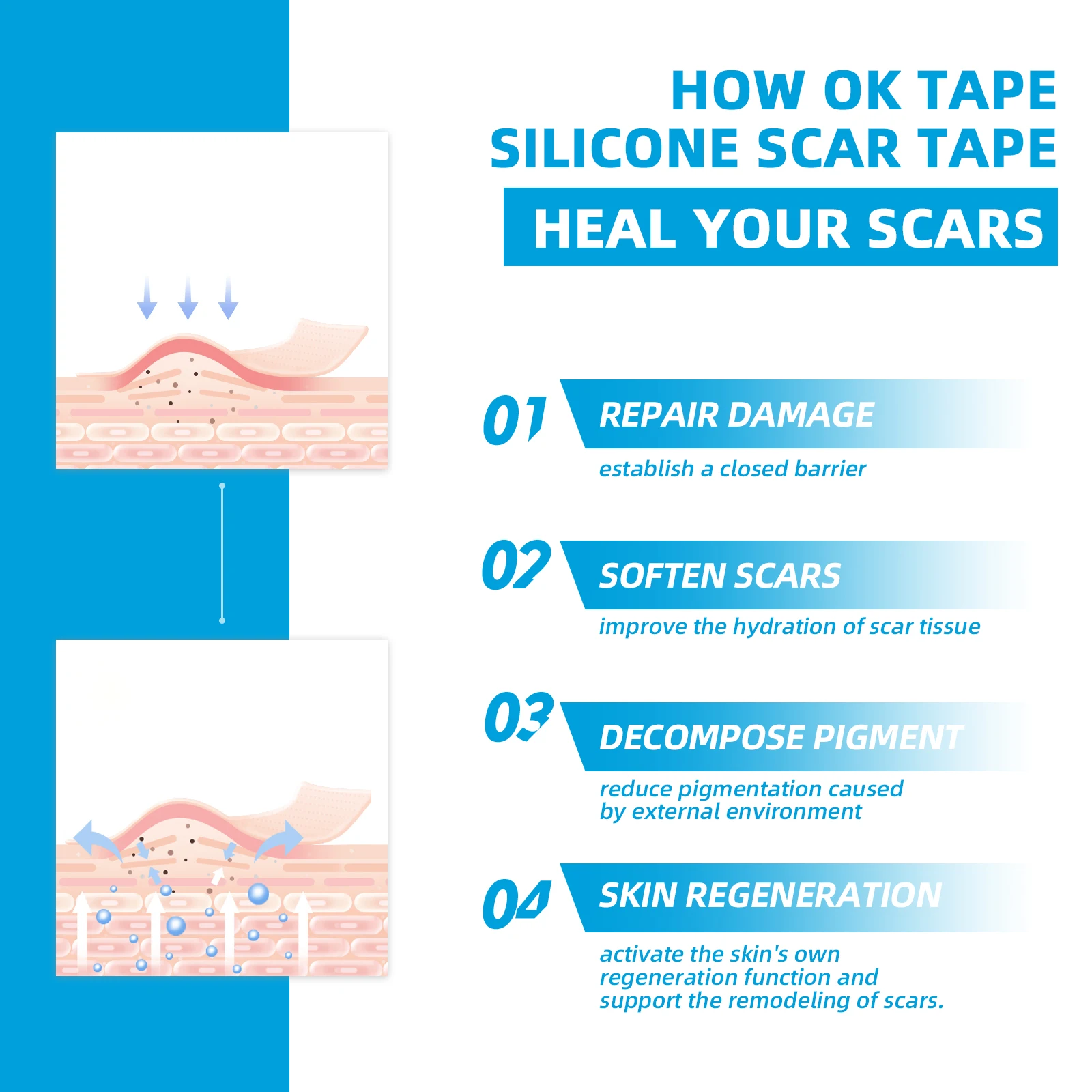 OK TAPE 1.8-3M Silicone Scar Tape Reusable Professional Scar Removal Sheets for Surgical Scar Tummy Tuck C-Section Burn Acne