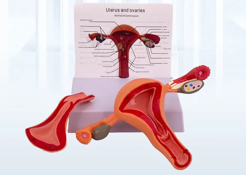 Human uterus model teaching tool mold ovarian anatomy pathology medical model