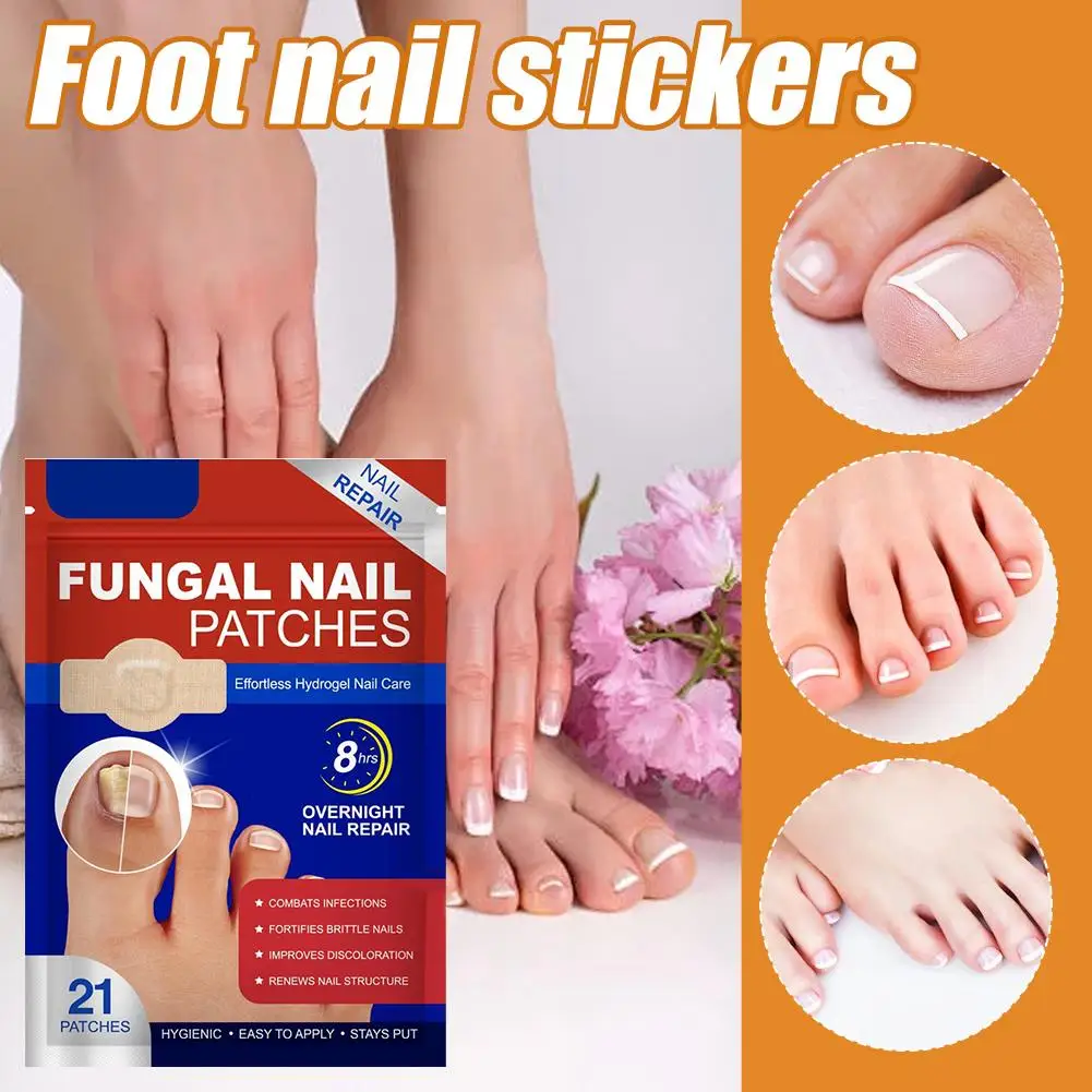 Parche para hongos en las uñas de los pies, parches impermeables para reparación de uñas, pegatina de corrección encarnada, herramienta para el cuidado de los pies, descolorida y dañada, 21 Uds.