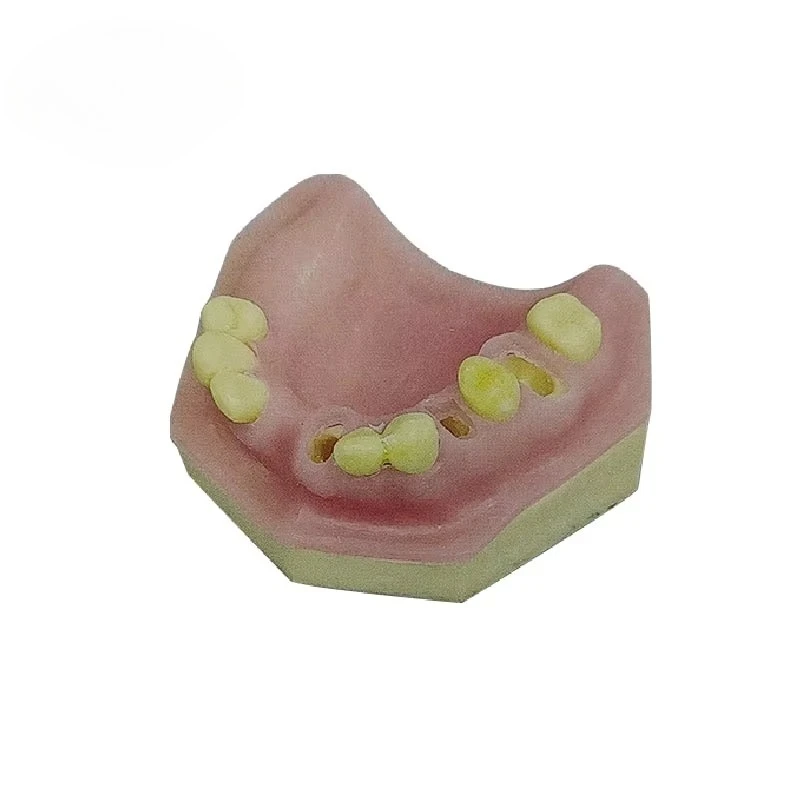 

The DentalS Education Model Is The Practice Model of Immediate Implantation