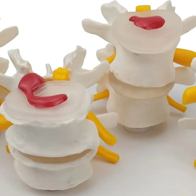 

4-ступенчатая патологическая модель анатомии поясничного отдела позвоночника человека, медицинские науки, анатомические учебные ресурсы, Прямая поставка