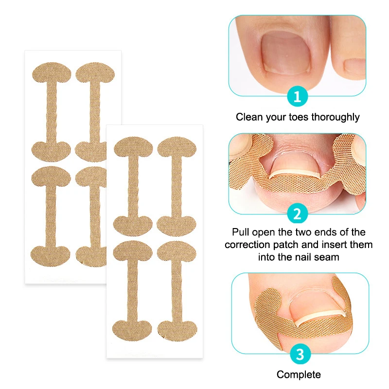 

Professional Ingrown Toenail Foot Corrector Stickers Set Toe Nail Care Pedicure Tools Health Care Protects Paronychia Treatment