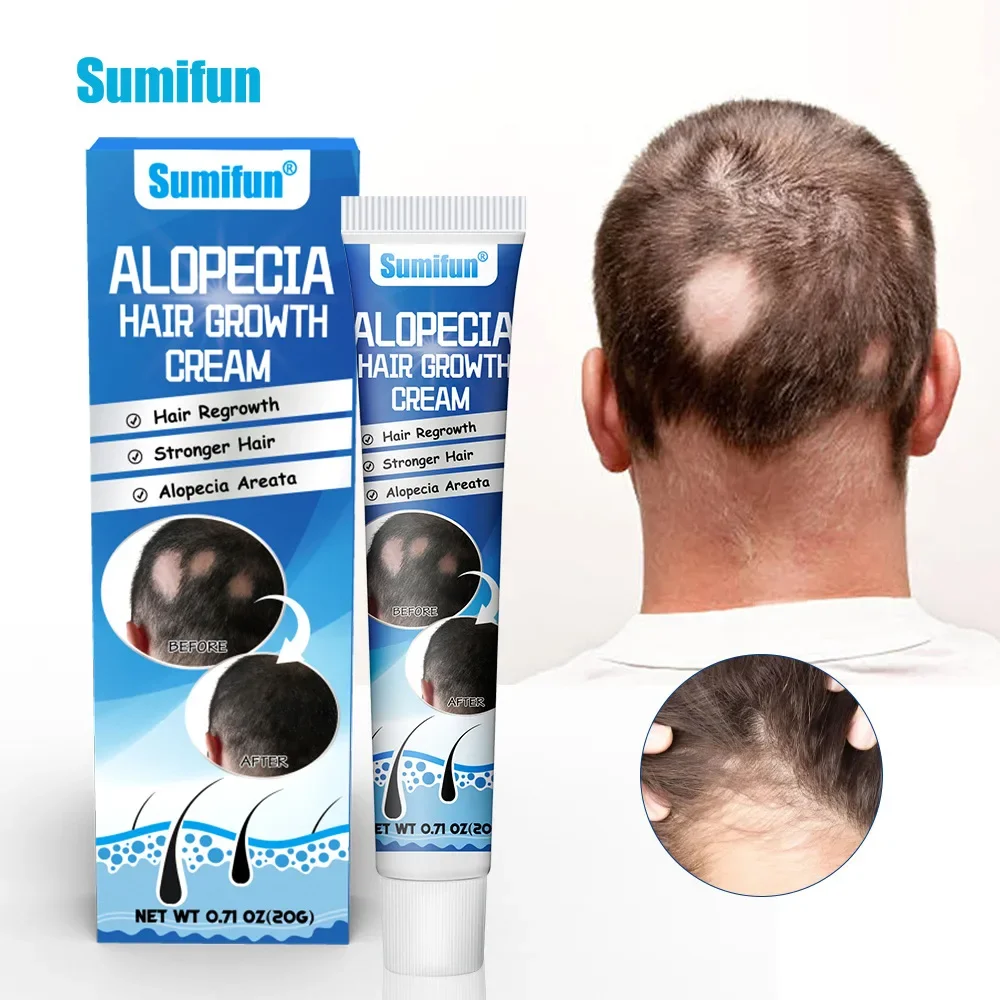 

Крем Sumifun Alopecia для лечения роста волос, питательный пластырь для восстановления облысения и восстановления роста волос, 1 шт.