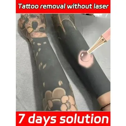 Tattoo Removal Gel Dissolve Tattoo Repair Skin Moisturizing Painless Deep Cleansing Care Gel