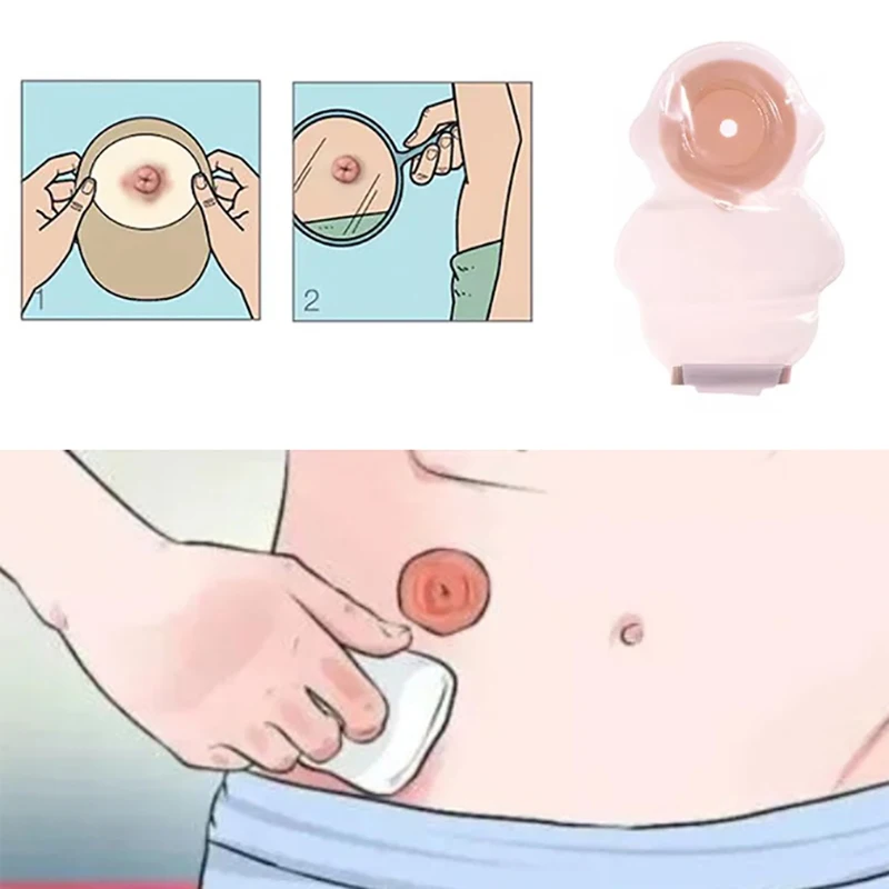 

【1Pcs Pediatric Drainable Colostomy Bag Portable Sticky Closure Carton Design For Kids Odor-free Stoma Care Bags】