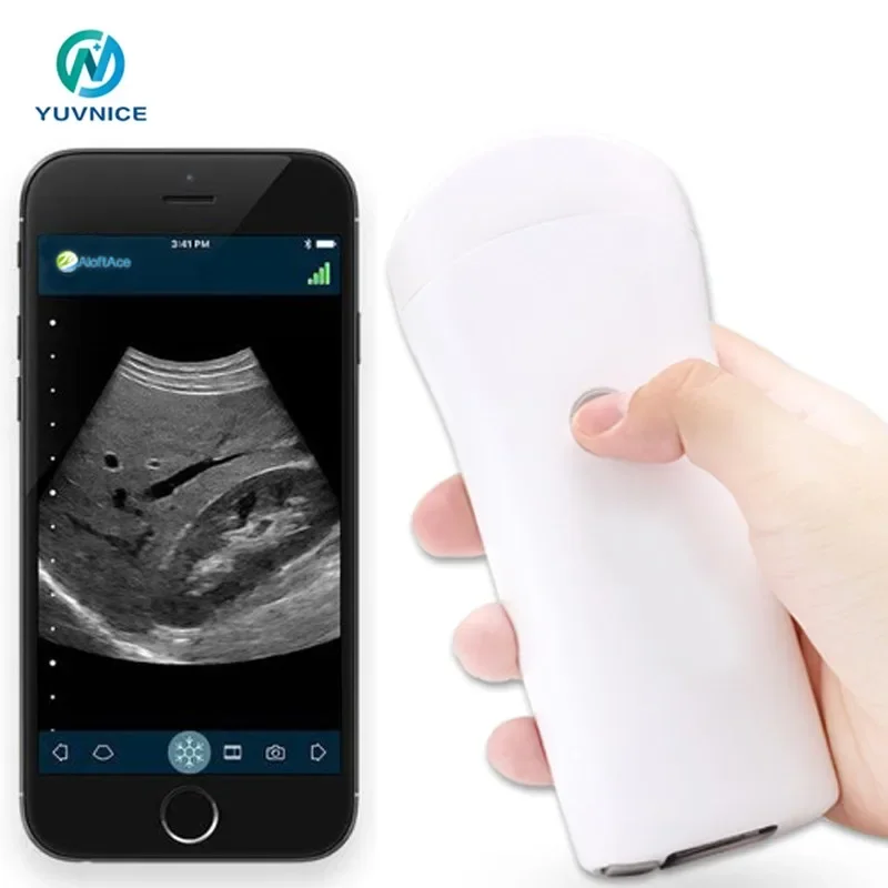 Portable Mini USG Wifi Smartphone Wireless Ultrasound Probe For Android, IOS,Windows