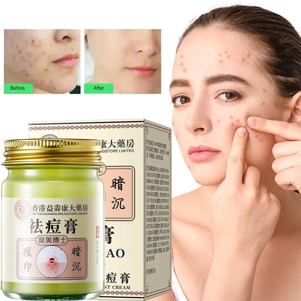 Crema para eliminar el acné a base de hierbas, tratamiento facial, trasero, marcas de acné, reparación suave, crema para la piel de pollo, blanqueamiento hidratante